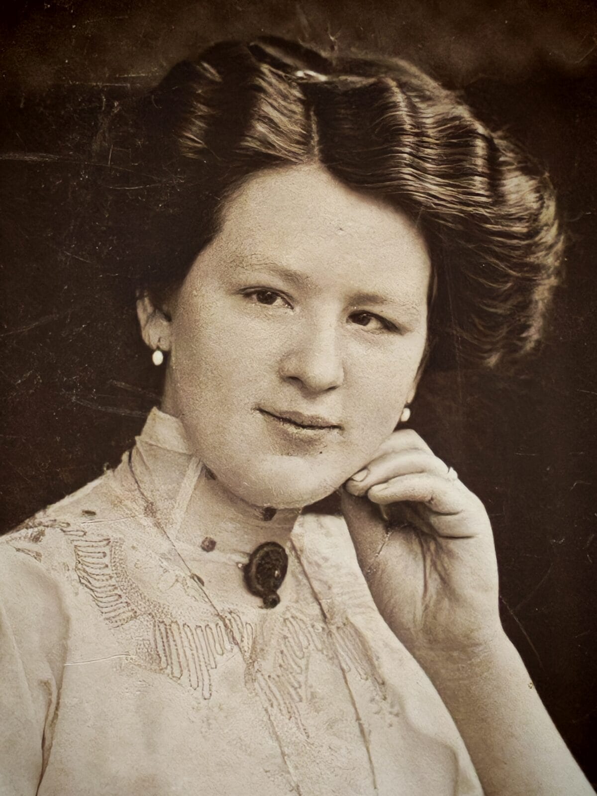 Altona klamra, Klamra